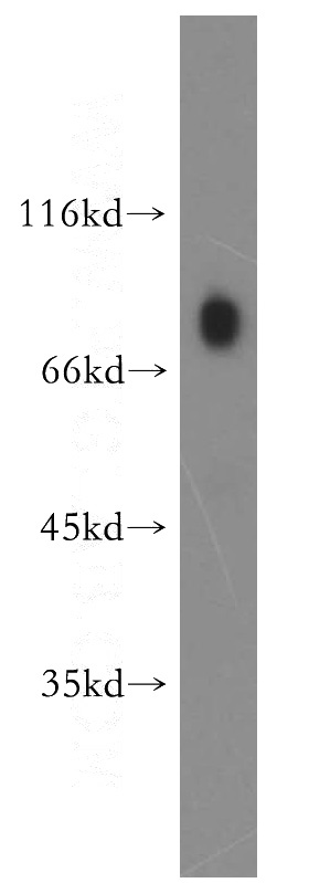 human placenta tissue were subjected to SDS PAGE followed by western blot with Catalog No:116683(USP44 antibody) at dilution of 1:500
