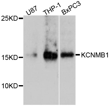 Western blot - KCNMB1 Polyclonal Antibody 