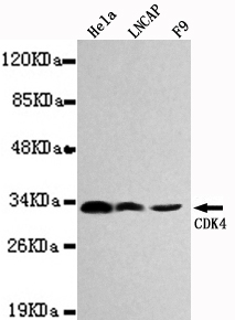 Western blot detection of CDK4 in Hela,Lncap and F9 cell lysates using CDK4 mouse mAb (1:1000 diluted).Predicted band size:34KDa.Observed band size:33KDa.