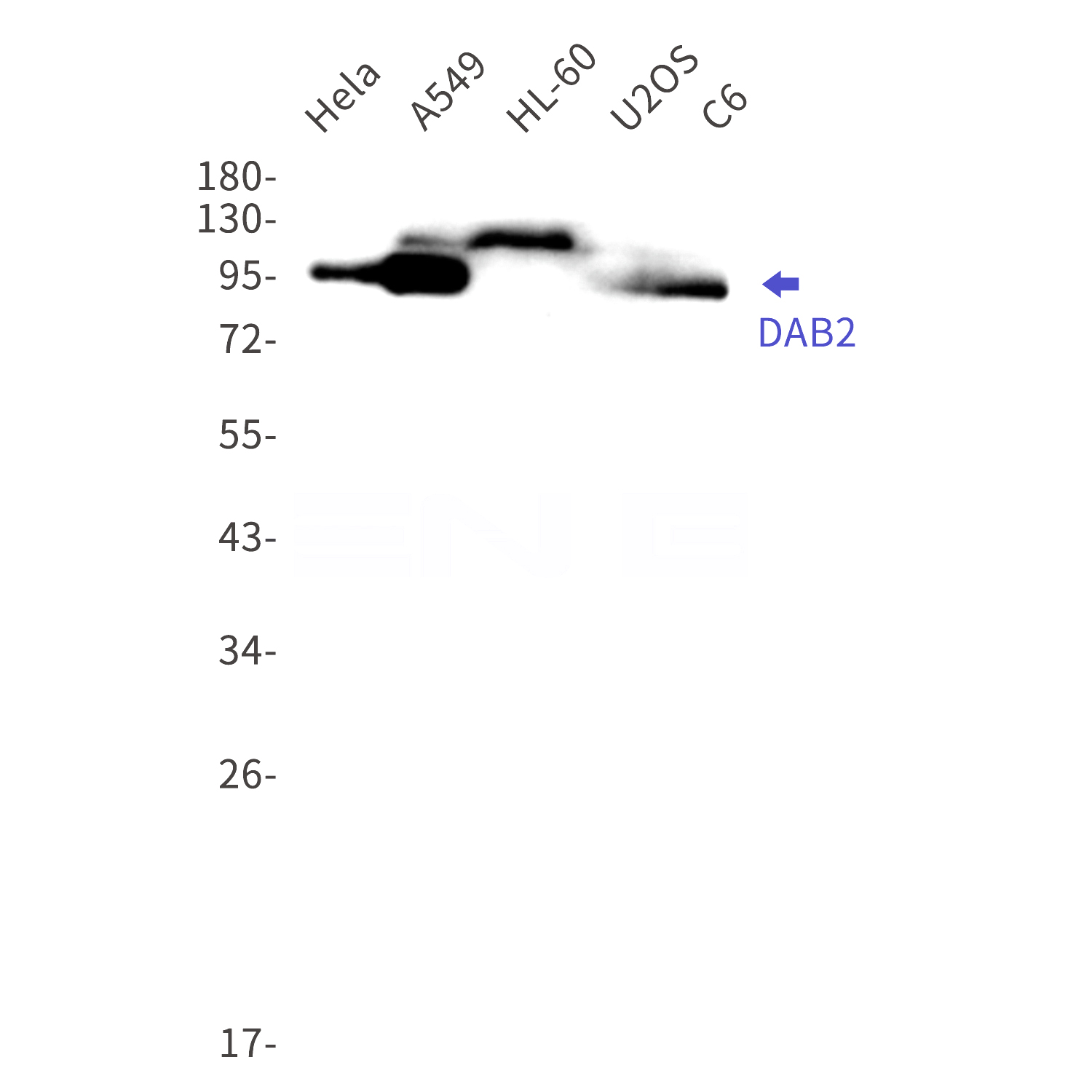 Western blot detection of DAB2 in Hela,A549,HL-60,U2OS,C6 cell lysates using DAB2 Rabbit mAb(1:1000 diluted).Predicted band size:83kDa.Observed band size:96kDa.