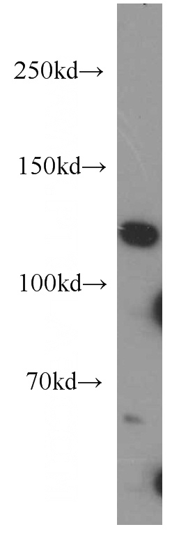 HEK-293 cells were subjected to SDS PAGE followed by western blot with Catalog No:116879(XYLT1 antibody) at dilution of 1:300