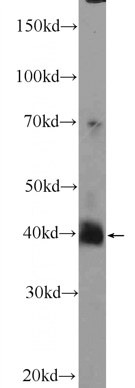 mouse brain tissue were subjected to SDS PAGE followed by western blot with Catalog No:111719(ELAVL4 Antibody) at dilution of 1:2000