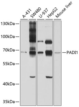 Western blot - PADI1 Polyclonal Antibody 
