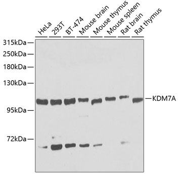 Western blot - KDM7A Polyclonal Antibody 