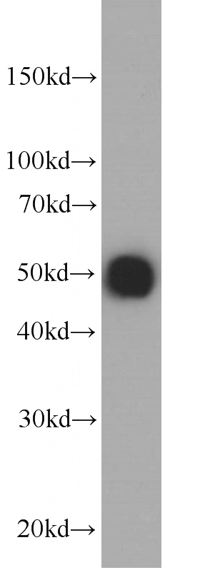 Recombinant protein were subjected to SDS PAGE followed by western blot with Catalog No:117325(HA-tag Antibody) at dilution of 1:20000