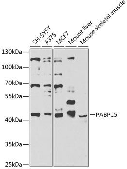 Western blot - PABPC5 Polyclonal Antibody 