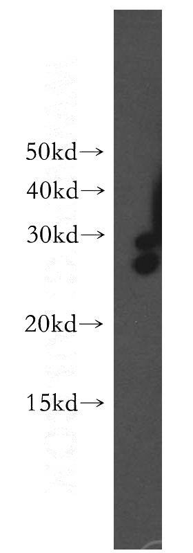 human liver tissue were subjected to SDS PAGE followed by western blot with Catalog No:109923(DHRS2 antibody) at dilution of 1:500