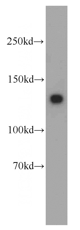 mouse uterus tissue were subjected to SDS PAGE followed by western blot with Catalog No:112972(MYLK antibody) at dilution of 1:500