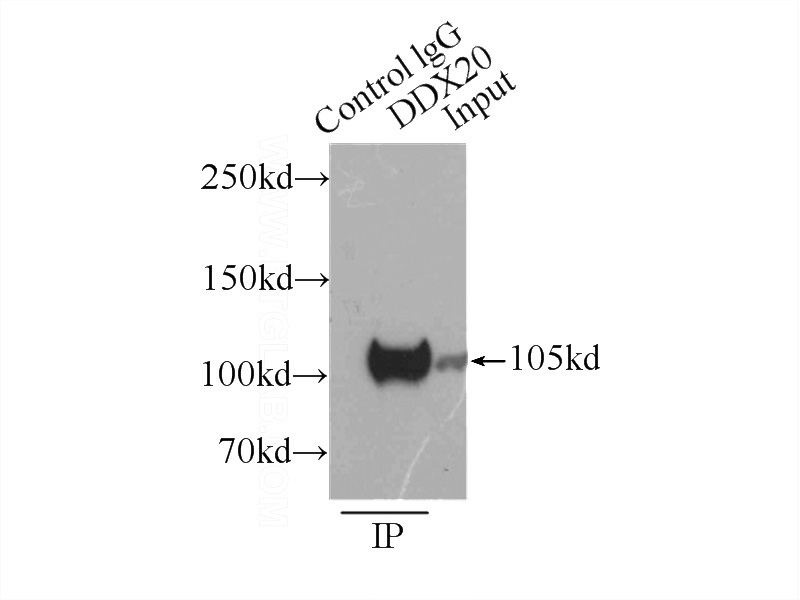 IP Result of anti-DDX20 (IP:Catalog No:109820, 4ug; Detection:Catalog No:109820 1:1000) with HeLa cells lysate 3000ug.