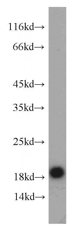 Jurkat cells were subjected to SDS PAGE followed by western blot with Catalog No:111487(HMGN2 antibody) at dilution of 1:600