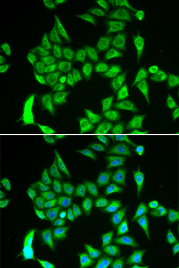 Immunofluorescence - IREB2 Polyclonal Antibody 