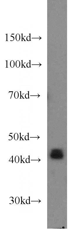 HeLa cells were subjected to SDS PAGE followed by western blot with Catalog No:107252(EIF3M antibody) at dilution of 1:1000