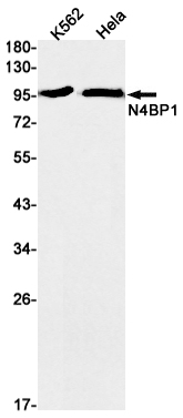 Western blot detection of N4BP1 in K562,Hela cell lysates using N4BP1 Rabbit mAb(1:1000 diluted).Predicted band size:99kDa.Observed band size:99kDa.