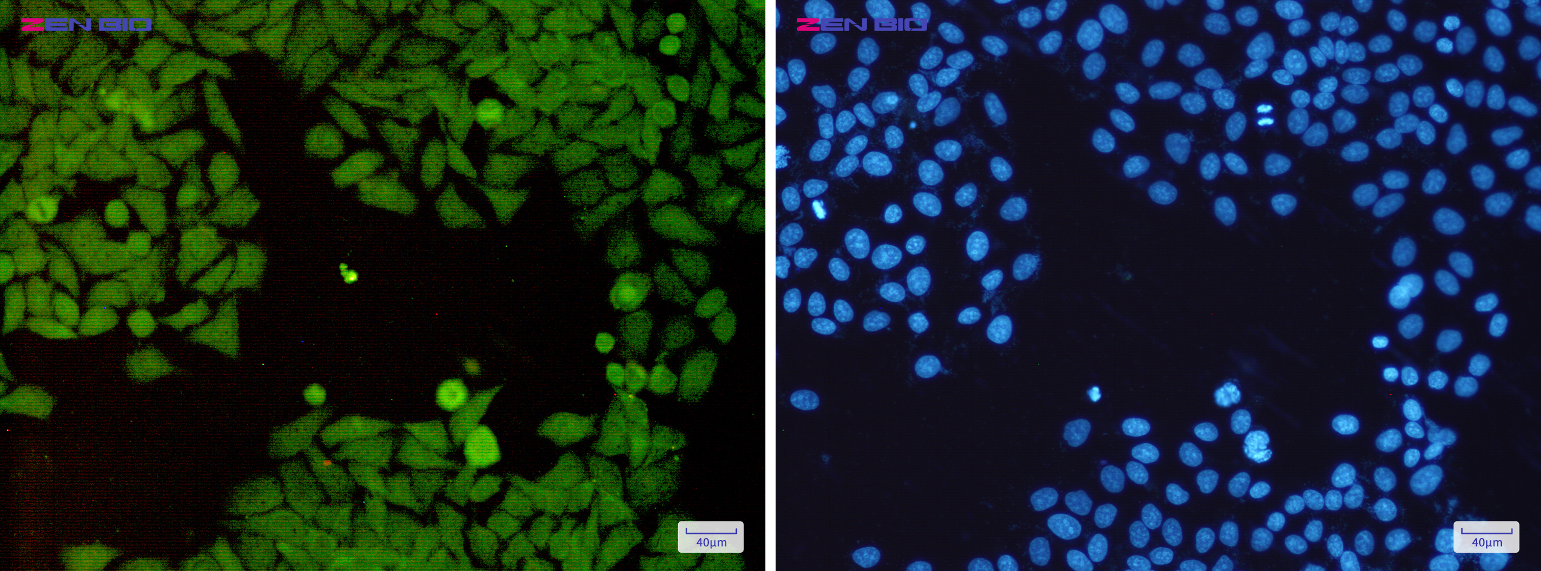 Immunocytochemistry of PSMD14(green) in Hela cells using PSMD14 Rabbit pAb at dilution 1/50, and DAPI(blue)