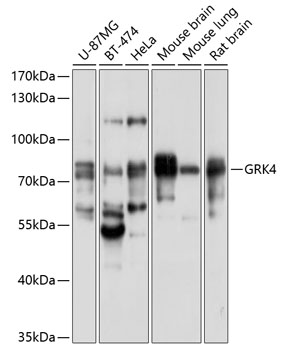 Western blot - GRK4 Polyclonal Antibody 
