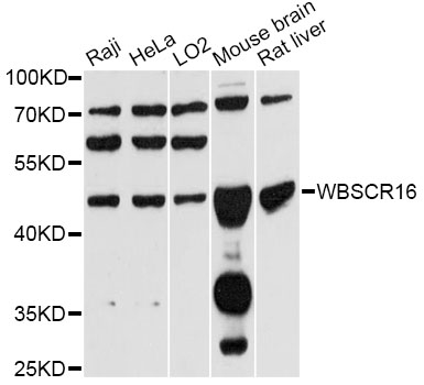 Western blot - WBSCR16 Polyclonal Antibody 