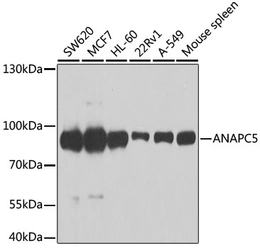 Western blot - ANAPC5 Polyclonal Antibody 