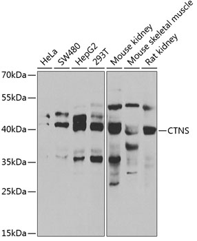 Western blot - CTNS Polyclonal Antibody 