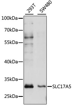 Western blot - SLC17A5 Polyclonal Antibody 