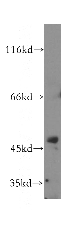 HeLa cells were subjected to SDS PAGE followed by western blot with Catalog No:110524(FARS2 antibody) at dilution of 1:500