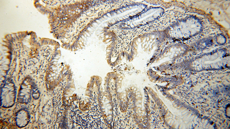 Immunohistochemical of paraffin-embedded human colon using Catalog No:109004(CCL28 antibody) at dilution of 1:50 (under 10x lens)