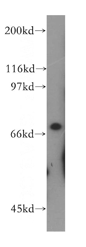 human kidney tissue were subjected to SDS PAGE followed by western blot with Catalog No:113724(PES1 antibody) at dilution of 1:400