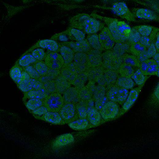 Fig2: ICC staining Geminin in D3 cells (green). Cells were fixed in paraformaldehyde, permeabilised with 0.25% Triton X100/PBS and counterstained with DAPI in order to highlight the nucleus (blue).