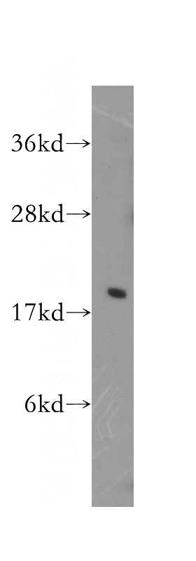 HeLa cells were subjected to SDS PAGE followed by western blot with Catalog No:110267(EIF5A antibody) at dilution of 1:400