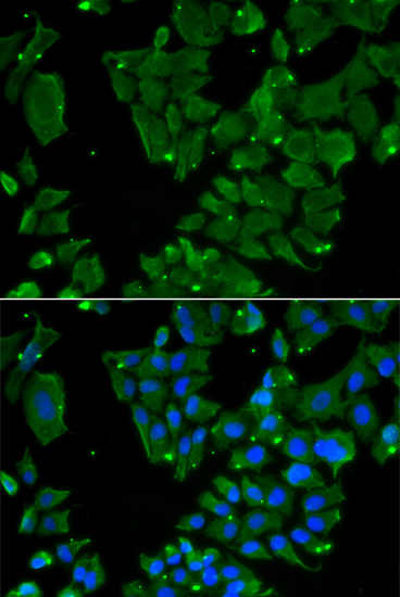 Immunofluorescence - DBN1 Polyclonal Antibody 