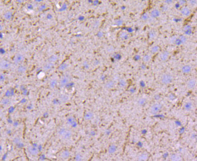 Fig2: Immunohistochemical analysis of paraffin-embedded mouse brain tissue using anti-Filamin A antibody. Counter stained with hematoxylin.