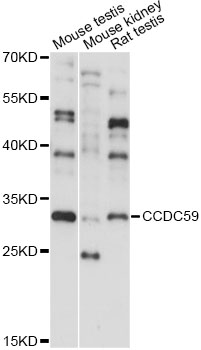 Western blot - CCDC59 Polyclonal Antibody 