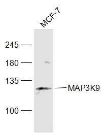 Fig1: Sample:; MCF-7(Human) Cell Lysate at 30 ug; Primary: Anti-MAP3K9 at 1/1000 dilution; Secondary: IRDye800CW Goat Anti-Rabbit IgG at 1/20000 dilution; Predicted band size: 122 kD; Observed band size: 122 kD
