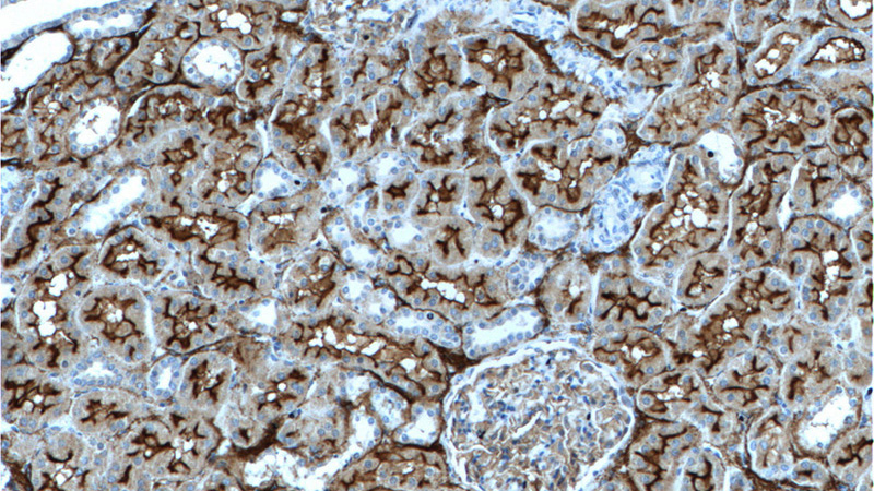 Immunohistochemistry of paraffin-embedded human kidney tissue slide using Catalog No:109039(CD10,MME Antibody) at dilution of 1:200 (under 10x lens)