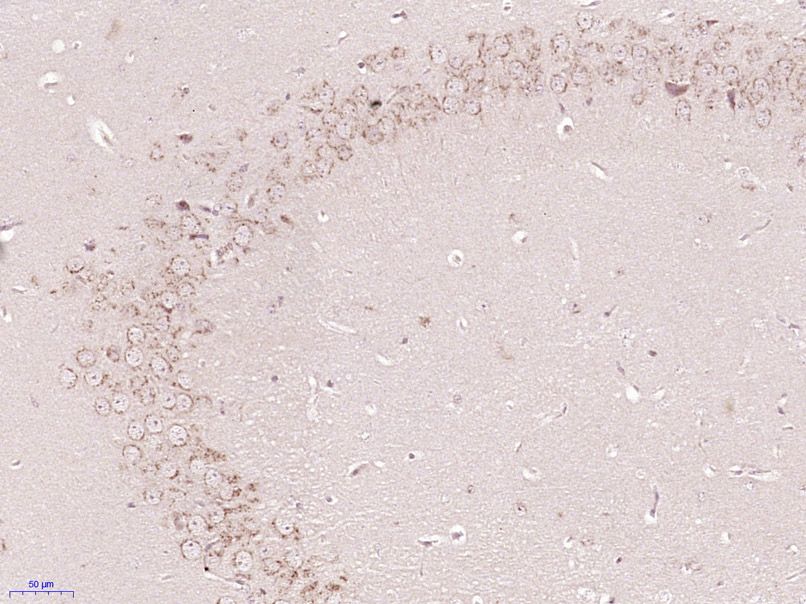 Fig3: Paraformaldehyde-fixed, paraffin embedded (Mouse brain); Antigen retrieval by boiling in sodium citrate buffer (pH6.0) for 15min; Block endogenous peroxidase by 3% hydrogen peroxide for 20 minutes; Blocking buffer (normal goat serum) at 37℃ for 30min; Antibody incubation with (Gliomedin) Polyclonal Antibody, Unconjugated at 1:400 overnight at 4℃, followed by operating according to SP Kit(Rabbit) (sp-0023) instructionsand DAB staining.