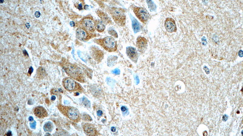 Immunohistochemistry of paraffin-embedded mouse brain tissue slide using Catalog No:109163(CDK5RAP1 Antibody) at dilution of 1:50 (under 40x lens)