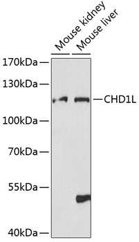 Western blot - CHD1L Polyclonal Antibody 