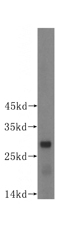 human brain tissue were subjected to SDS PAGE followed by western blot with Catalog No:113775(PGAM1 antibody) at dilution of 1:300