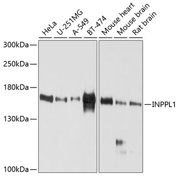 Western blot - INPPL1 Polyclonal Antibody 