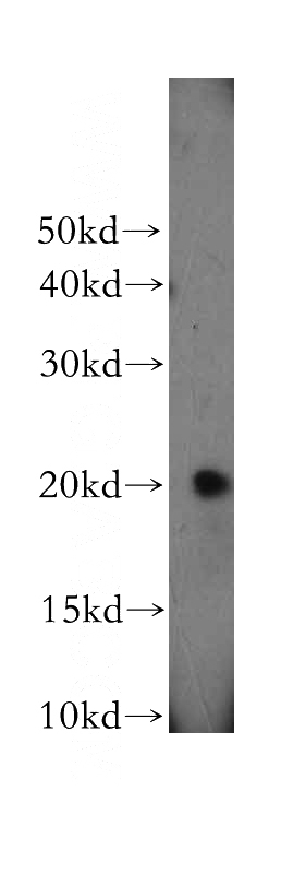 PC-3 cells were subjected to SDS PAGE followed by western blot with Catalog No:114126(PPIH antibody) at dilution of 1:200