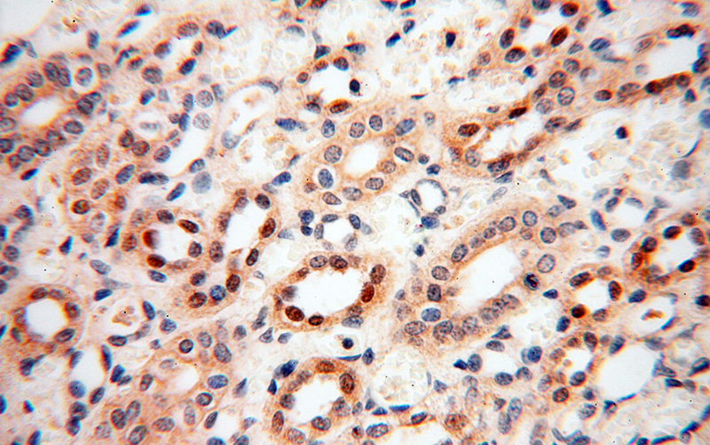 Immunohistochemical of paraffin-embedded human kidney using Catalog No:108071(ANKRD2 antibody) at dilution of 1:100 (under 40x lens)