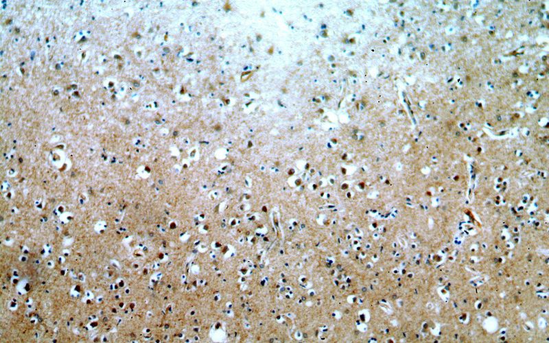 Immunohistochemical of paraffin-embedded human brain using Catalog No:109738(CUEDC2 antibody) at dilution of 1:100 (under 10x lens)