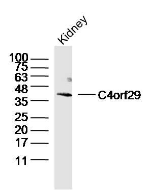 Fig1: Sample:Kidney (Mouse) Lysate at 40 ug; Primary: Anti-C4orf29 (b175268#)at 1/300 dilution; Secondary: IRDye800CW Goat Anti-Rabbit IgG at 1/20000 dilution; Predicted band size: 44kD; Observed band size: 44kD