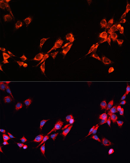 Immunofluorescence - PGRMC2 Polyclonal Antibody 