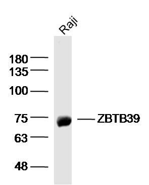 Fig2: Sample: Raji (human)cell Lysate at 40 ug; Primary: Anti- ZBTB39 at 1/300 dilution; Secondary: IRDye800CW Goat Anti-RabbitIgG at 1/20000 dilution; Predicted band size: 79 kD; Observed band size: 75 kD