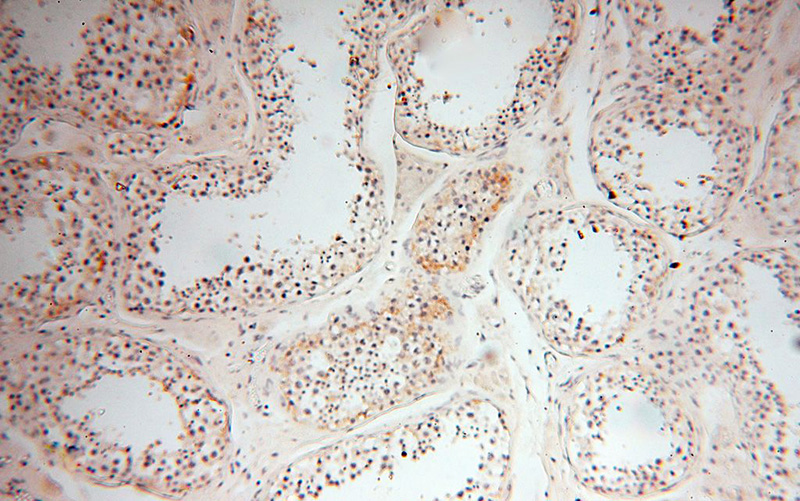 Immunohistochemical of paraffin-embedded human testis using Catalog No:116309(TRIM29 antibody) at dilution of 1:100 (under 10x lens)
