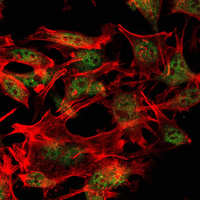 Immunofluorescence analysis of LOVO cells using SETDB1 mouse mAb (green). Red: Actin filaments have been labeled with Alexa Fluor-555 phalloidin.