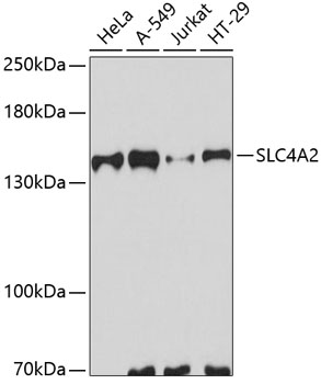 Western blot - SLC4A2 Polyclonal Antibody 