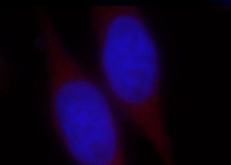 Immunofluorescent analysis of Hela cells, using WDR45 antibody Catalog No:116868 at 1:25 dilution and Rhodamine-labeled goat anti-rabbit IgG (red). Blue pseudocolor = DAPI (fluorescent DNA dye).