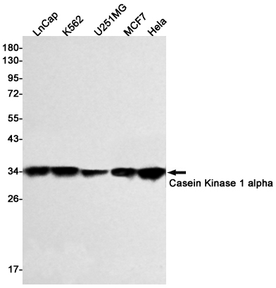 Western blot detection of Casein Kinase 1 alpha in LnCap,K562,U251MG,MCF7,Hela cell lysates using Casein Kinase 1 alpha Rabbit mAb(1:500 diluted).Predicted band size:39kDa.Observed band size:34kDa.