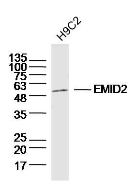 Fig2: Sample:H9C2 (Rat)Cell Lysate at 40 ug; Primary: Anti-EMID2 at 1/300 dilution; Secondary: IRDye800CW Goat Anti-RabbitIgG at 1/20000 dilution; Predicted band size: 45kD; Observed band size: 55kD